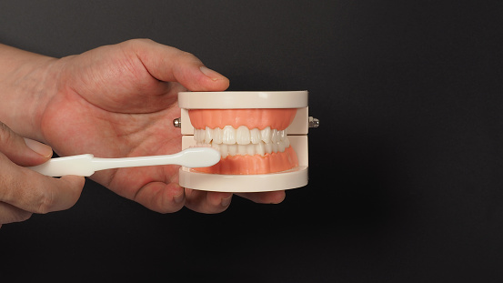 Cast Partial Denture